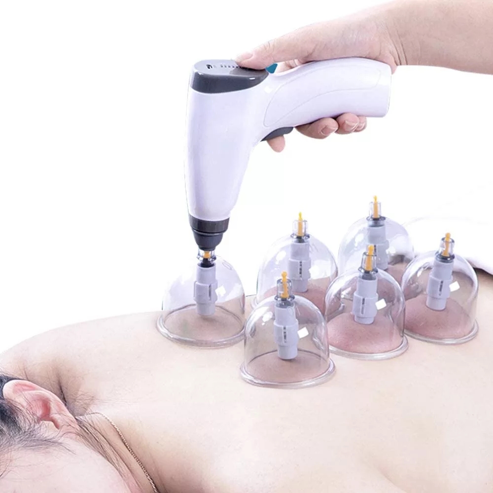 ดูดถ้วย AntiCellulite ไฟฟ้า Ba - Cupping Therapy Set บทวิจารณ์และราคา