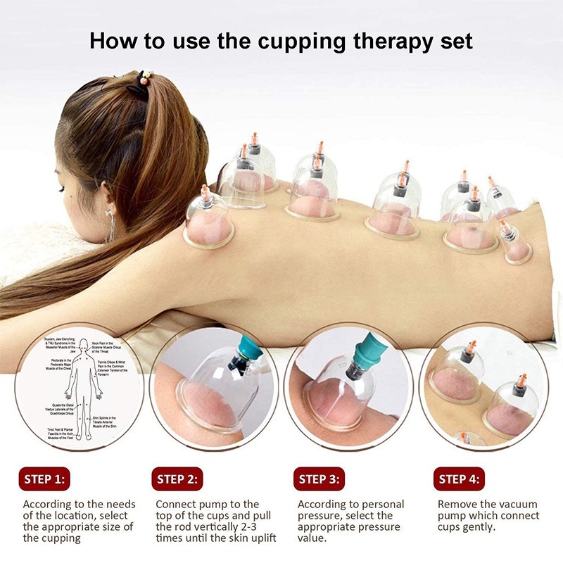 6or24 ชิ้นดูดถ้วยนวดสูญญากาศ C - Cupping Therapy Set บทวิจารณ์และราคา