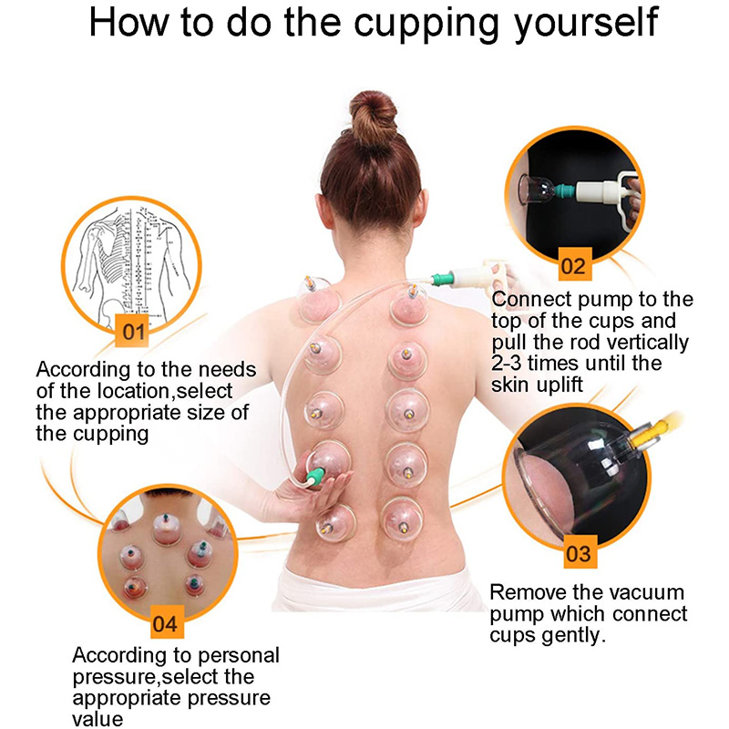 6or24 ชิ้นดูดถ้วยนวดสูญญากาศ C - Cupping Therapy Set บทวิจารณ์และราคา