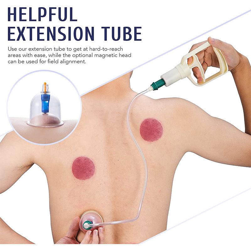 6or24 ชิ้นดูดถ้วยนวดสูญญากาศ C - Cupping Therapy Set บทวิจารณ์และราคา