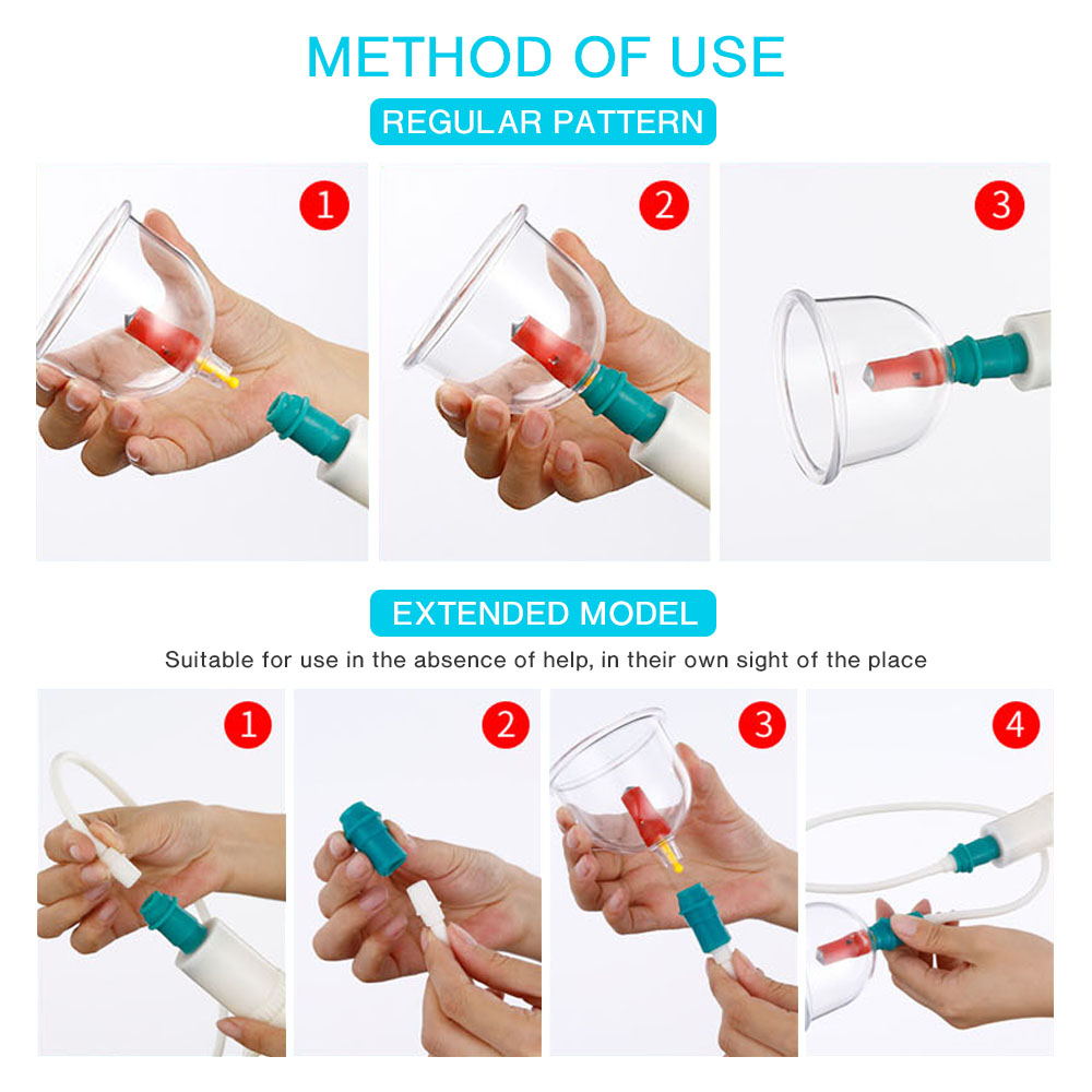24/12 กระป๋องสูญญากาศ Cupping  - Cupping Therapy Set บทวิจารณ์และราคา